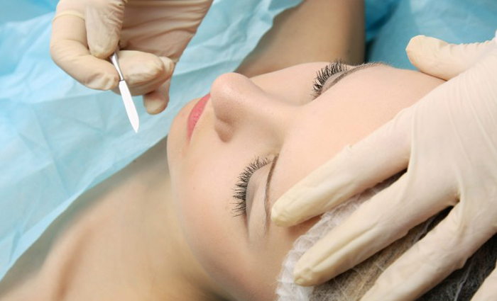 Dermaplaning in Ft Myers Florida