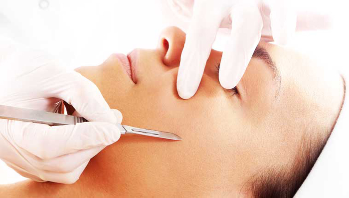 Dermaplaning in South Fort Myers Florida